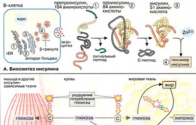 Сахарный диабет